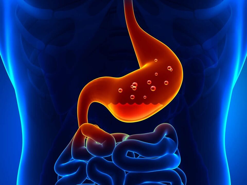Η γαστρίτιδα είναι μια φλεγμονώδης νόσος του στομάχου που απαιτεί δίαιτα